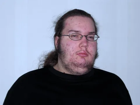 Butthurt Dweller